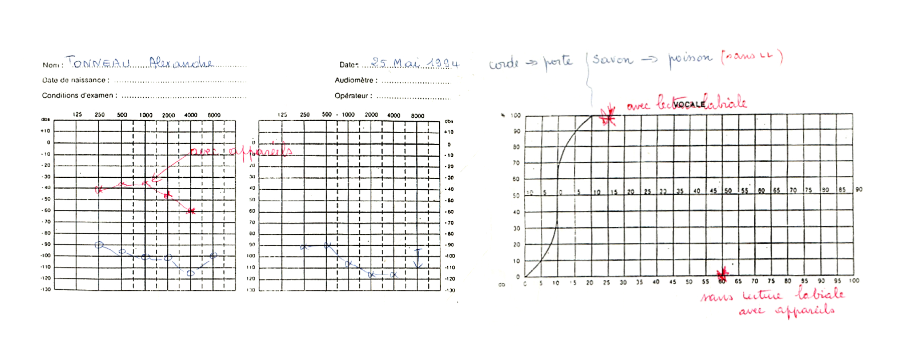 audio test results